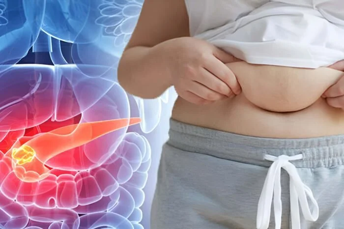 Obesity and Cancer Connection