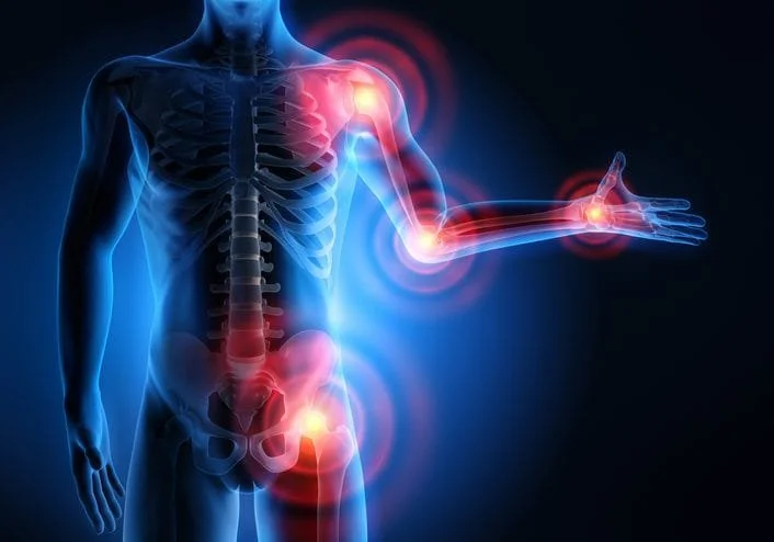 Obesity and Joint Knee Pain