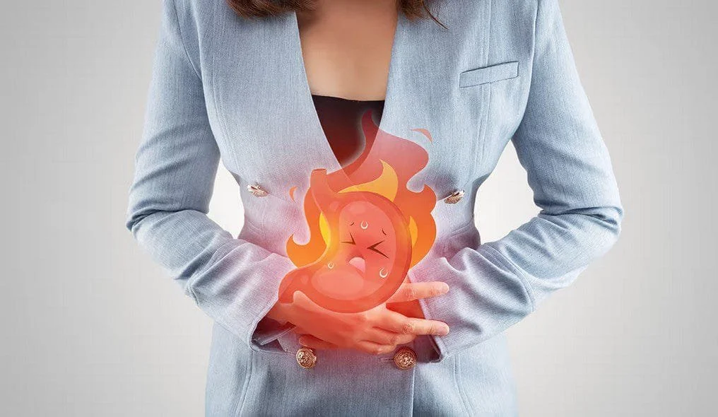 Obesity and Gastroesophageal Reflux Disease