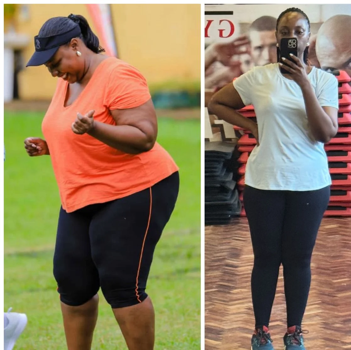 Lois Asiimwe pre-procedure fitness routine compared with post-surgery gym progress