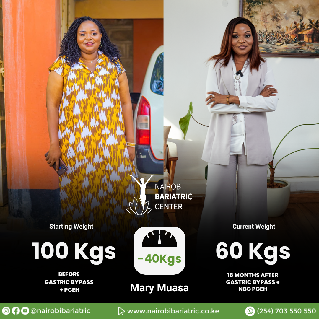 Mary Before and After Weight Loss