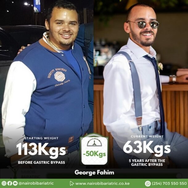 George Fahim Nairobi Bariatric Center Gastric Bypass