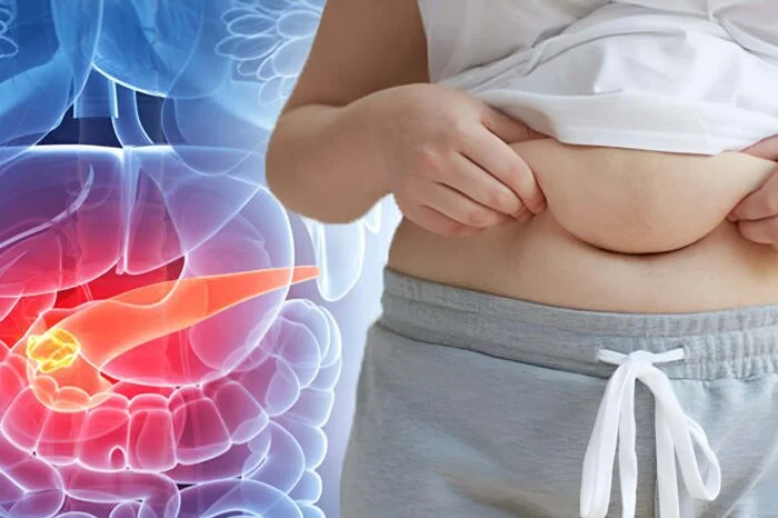 Obesity and Cancer Connection