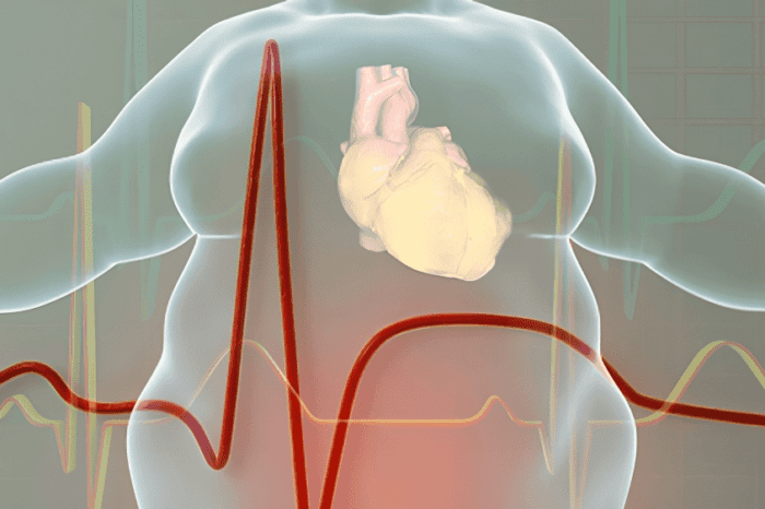 Obesity and Heart Disease | Lower Cardiac Risk by 30%