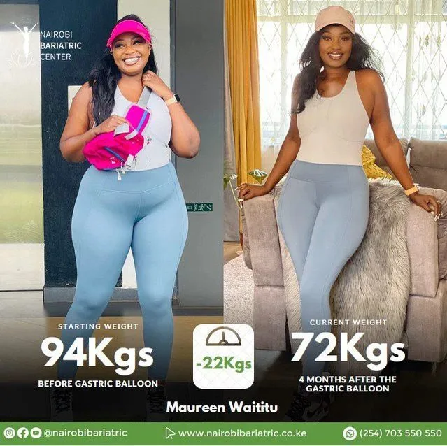 Maureen-Waititu-nairobi-bariatric