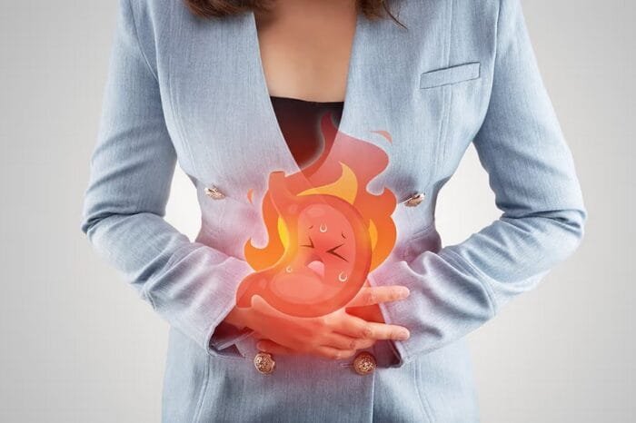 Obesity and Gastroesophageal Reflux Disease