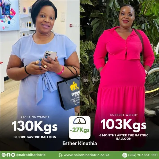 Esther_kinuthia_gastric_balloon